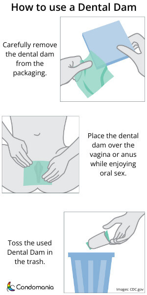 dental dam contraceptive in use