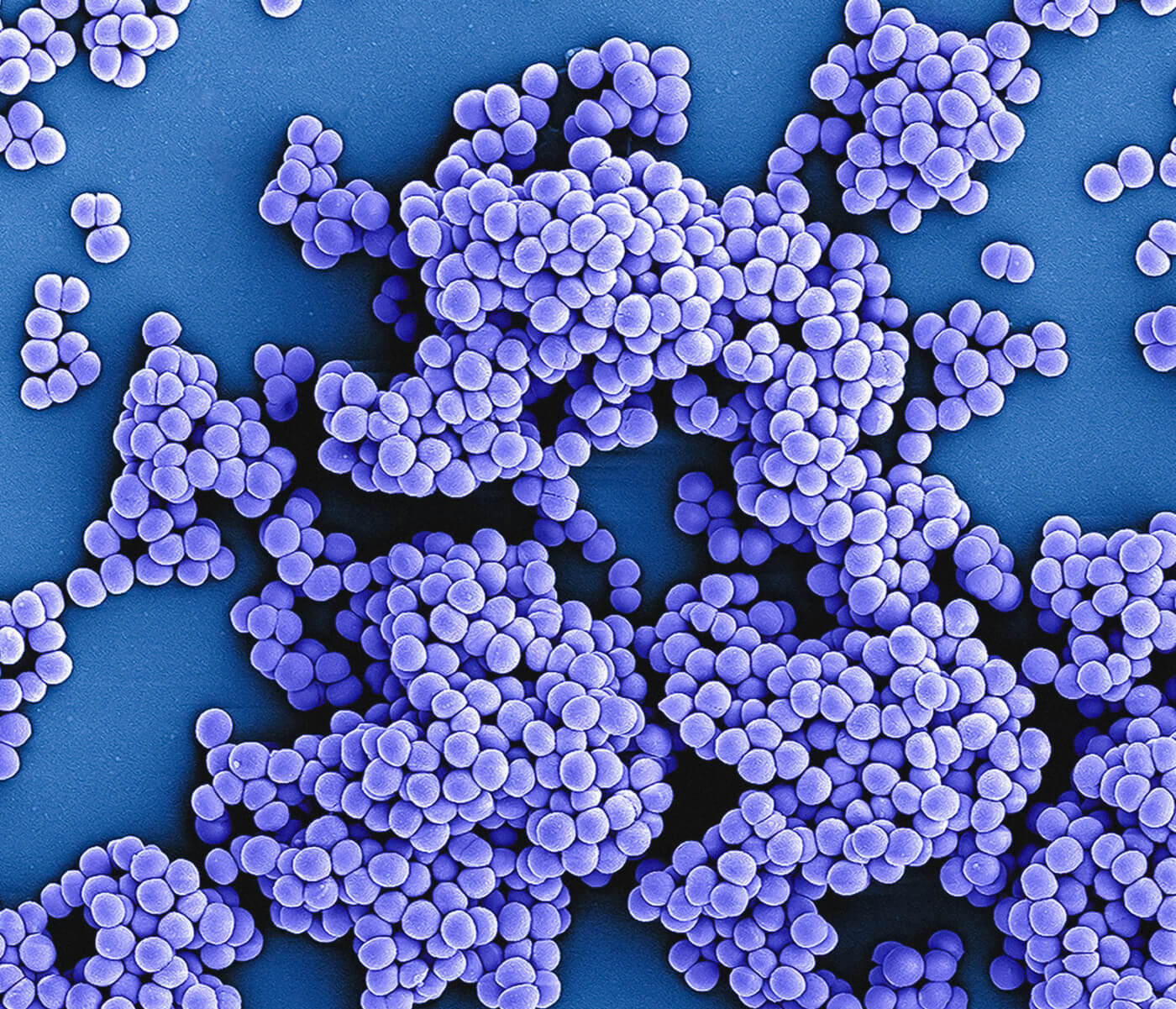 Image of staphylococcus aureus by National Institute of Allergy and Infectious Diseases