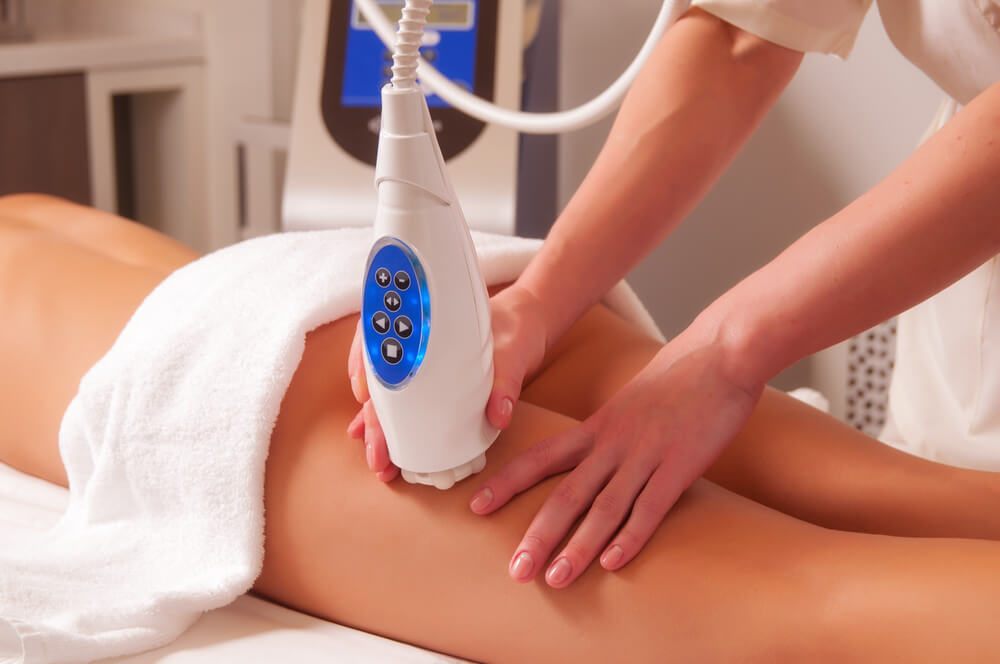 cellulite treatments; laser and heat