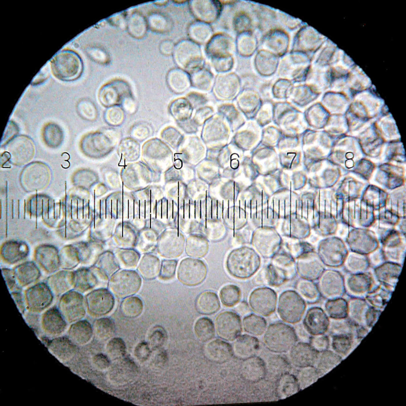 When You Rehydrate Yeast, It Looks like This