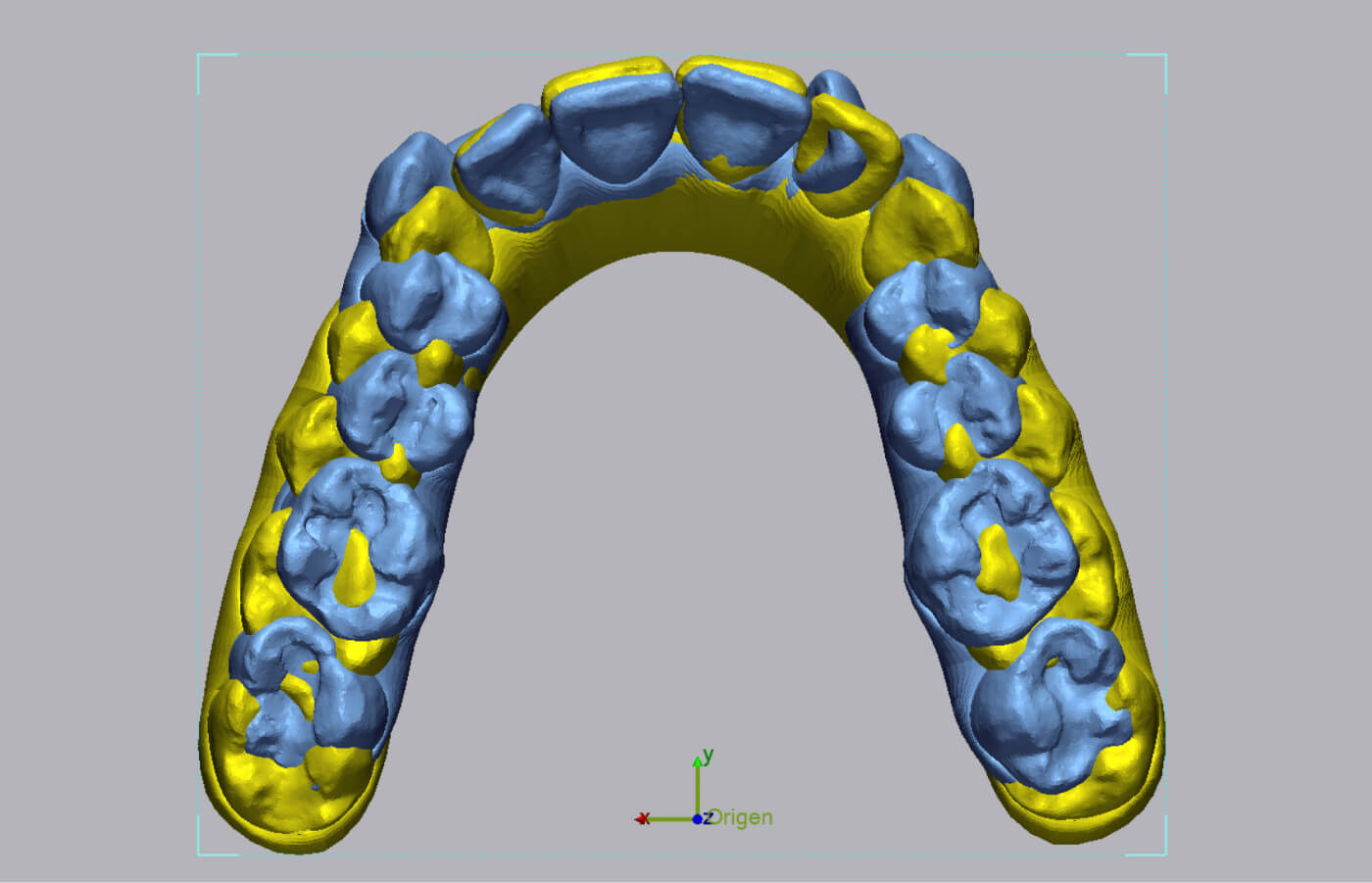 Image of 3D scans of teeth aligned in Geomagic Control X