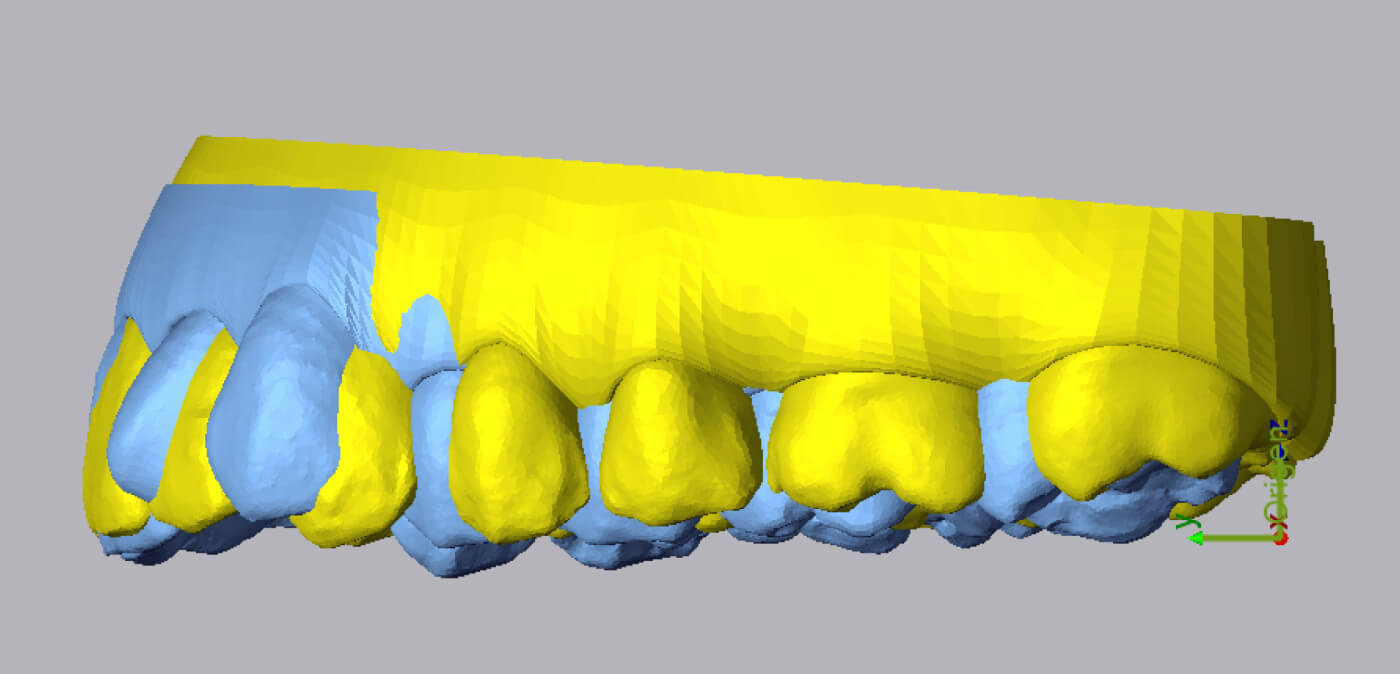 Picture of 3D scans of teeth inside Geomagic Control X