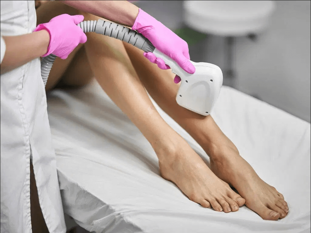 How Much is Brazilian Laser Hair Removal Cost? - Ulike