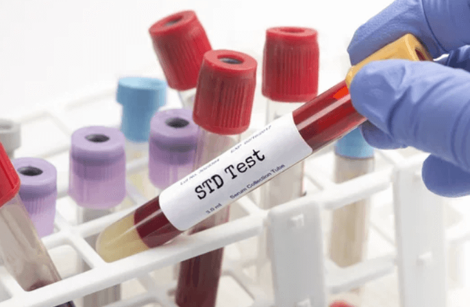 STD Test | Pelvic Inflammatory Disease PID | Condom Depot Learning Center