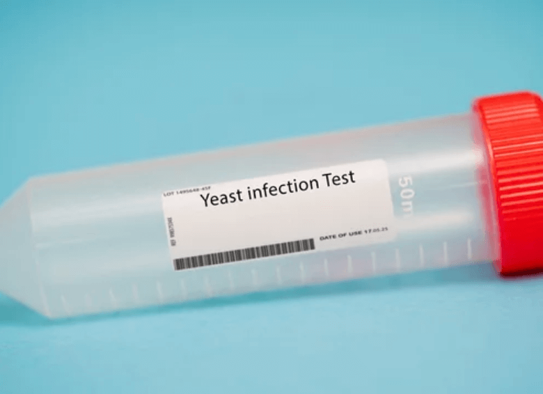 Yeast Infection Test | Can Men Get Yeast Infections | Condom Depot Learning Center